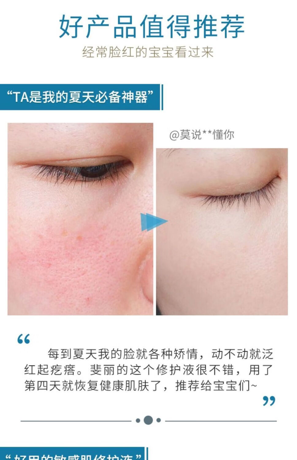 雅詩蘭黛修護精華_雅詩蘭黛即時修護_雅詩蘭黛細嫩修護精華露