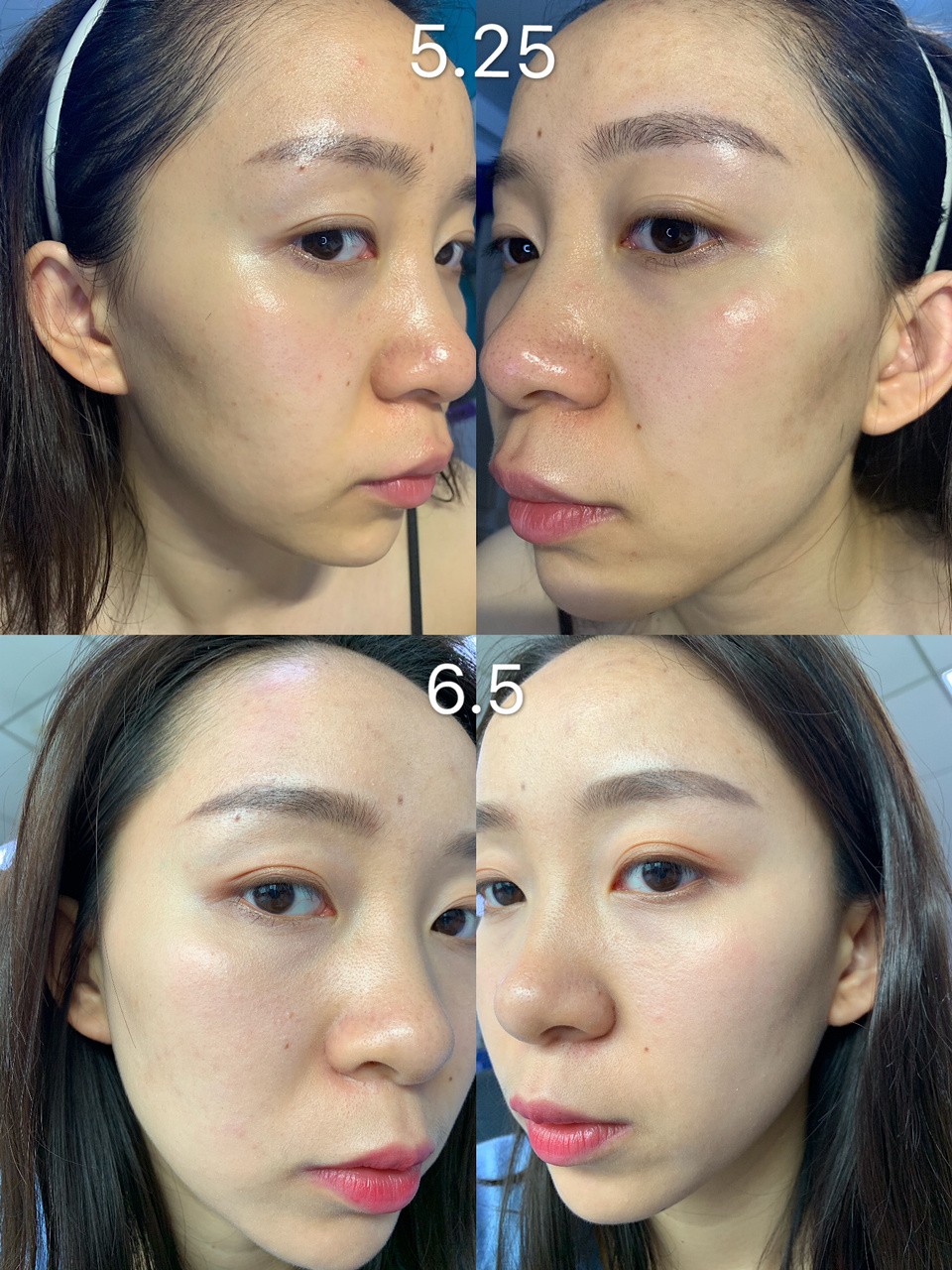雅詩蘭黛即時修護_雅詩蘭黛細嫩修護精華露_雅詩蘭黛修護精華