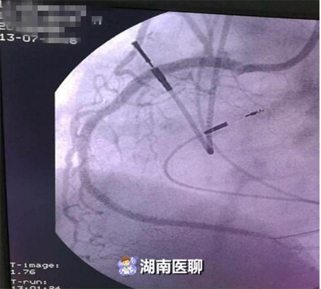 英語單詞發音是什么意思__發音英語意思
