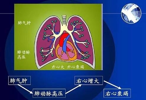 _百度百科發音_單詞發音是什么意思