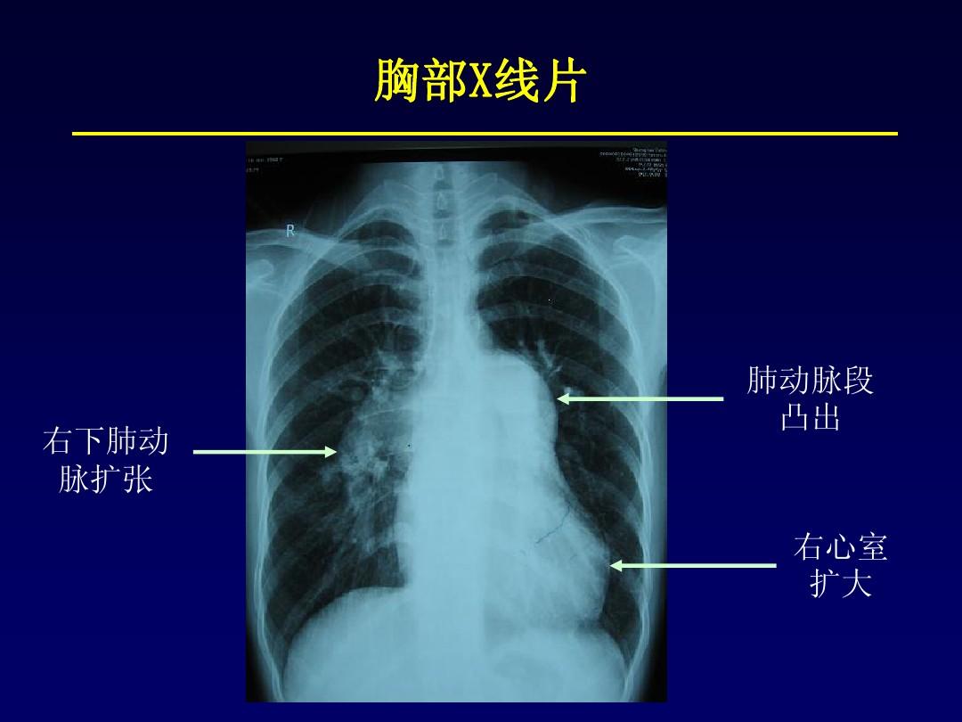 u的單詞發音單詞總結_英語發音是ow的單詞_