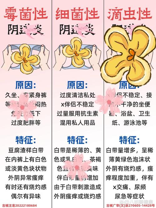vagina結(jié)構(gòu)特征_vagina是什么意思_y.d古人稱謂