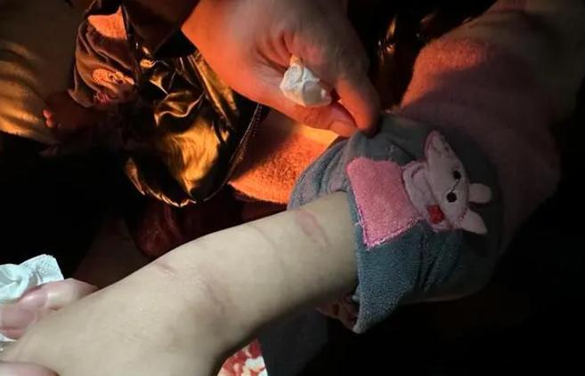 被同學打屁屁的故事_女童遭虐打事件_女童被虐打母親后悔