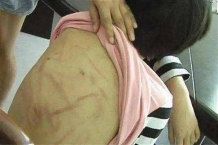 女童被虐打母親后悔_被同學打屁屁的故事_女童遭虐打事件