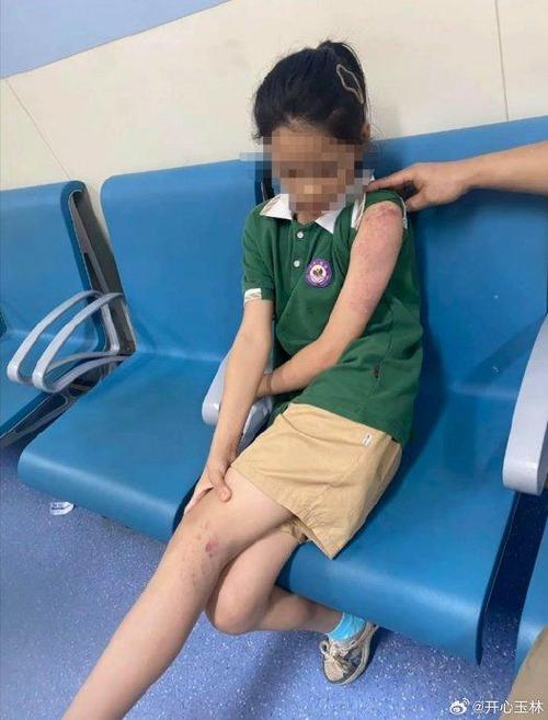 女童被虐打母親后悔_女童遭虐打事件_被同學打屁屁的故事