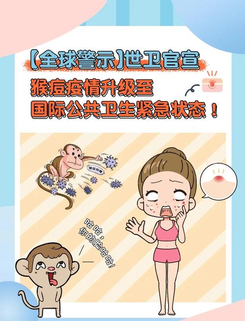 香港猴痘_香港猴痘檢疫期調整_香港猴痘疫情應變計劃