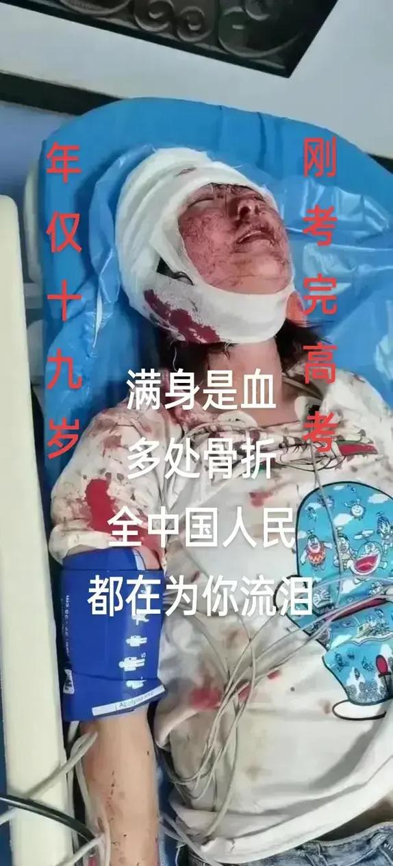 老鼠防治方法_農村滅鼠技巧_老鼠進風箱